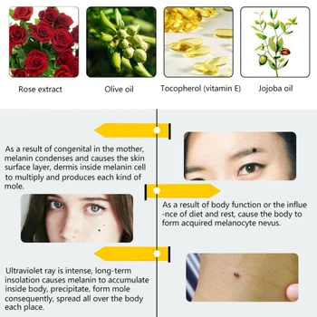 Rose Æterisk Olie Nærende Hud Fjernelse Af Modermærke Fregner Facial Lysere Kridtning Olie Face Serum 99073